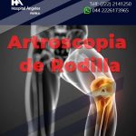 cirugía articular y artroscopia en Puebla